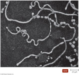 SEM of Mycoplasma pneumoniae showing filamentous structure