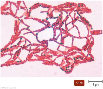 SEM of Bacillus anthracis showing chains of rod-shaped cells with endospores