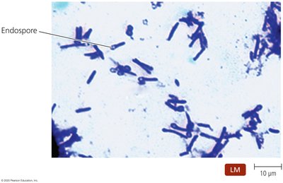 Light micrograph of Clostridium showing endospores