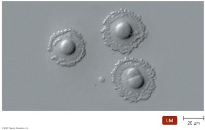 Light micrograph of Mycoplasma colonies