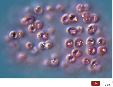 Deposits of sulfur within purple sulfur bacteria