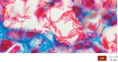 Acid-fast bacilli (Mycobacterium)