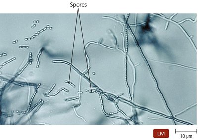 Branching filaments of actinomycetes
