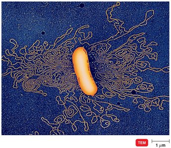 Transmission electron micrograph of a prokaryotic cell with supercoiled DNA