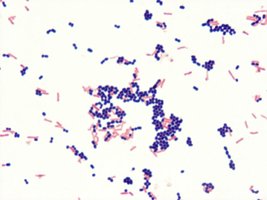 Mixed culture: Gram positive and negative