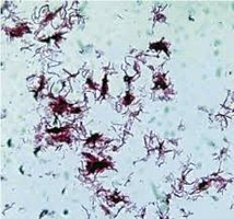 Acid-fast stained bacteria