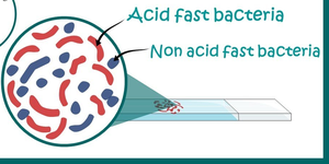 Acid-fast vs non-acid-fast bacteria