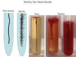 Motility test media results