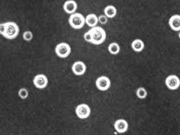 Negative staining showing bacterial capsules
