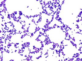 Gram positive bacteria