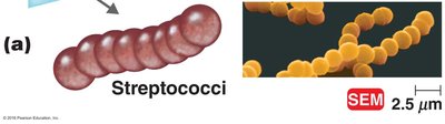 Streptococci chains, SEM image