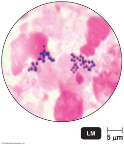 Chickenpox infection and viral latency in nerve ganglia