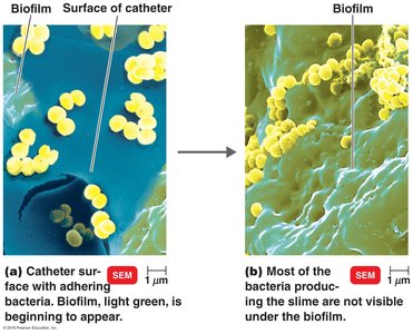 Biofilm formation by staphylococci on catheter surface