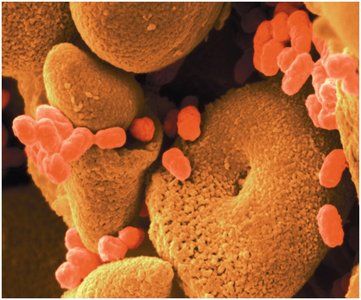 Microbial colonies on a surface