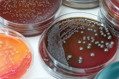 Blood agar plate showing hemolysis