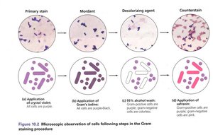 Microscopic observation of cells following steps in the Gram staining procedure