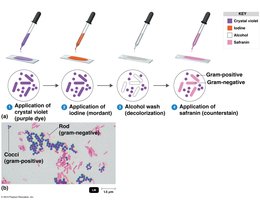 Gram staining steps and cell appearance