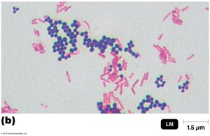Gram staining results: cocci and rods