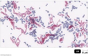 Acid-fast bacteria: M. bovis