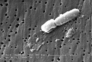 SEM image of bacteria