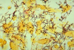 Gram stain showing bacilli