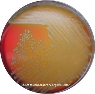 Blood agar plate showing hemolysis