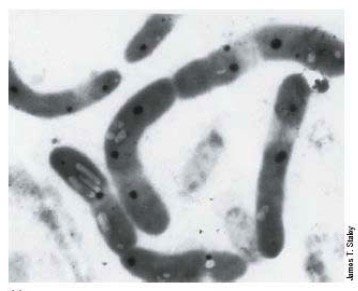 Psychrophile example: Polaromonas vacuolata