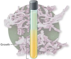 Anaerobes growth pattern