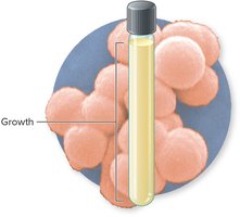 Aerotolerant anaerobes growth pattern