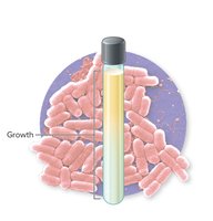 Facultative anaerobes growth pattern