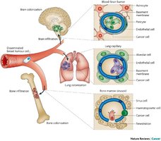 Hematogenous spread diagram