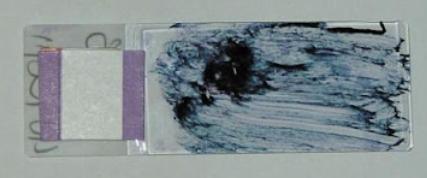Example of a conventional cytology slide