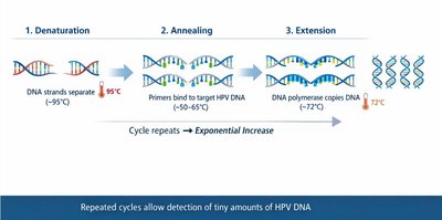 PCR process for HPV DNA detection