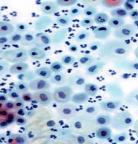 Parabasal and metaplastic cells