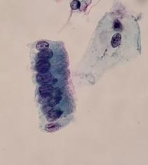 Histiocytes