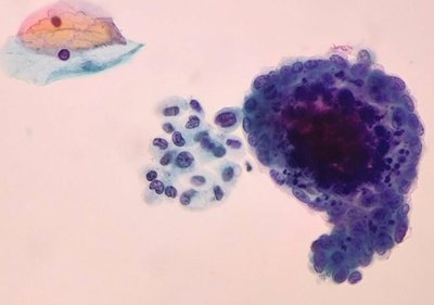 Red blood cells