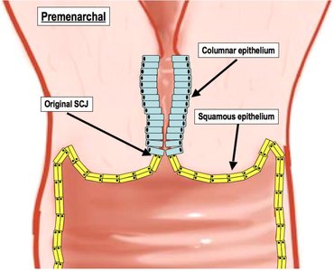 Premenarchal cervix: SCJ location