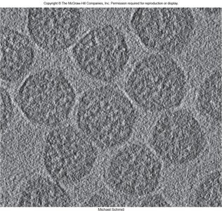 Electron micrograph of carboxysome microcompartments