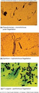 Examples of monotrichous, lophotrichous, and peritrichous flagellation