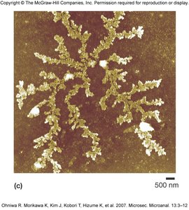 Electron micrograph showing DNA fibers from a ruptured bacterial cell