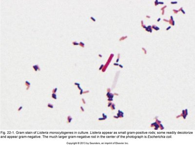 Gram stain of Listeria monocytogenes in culture