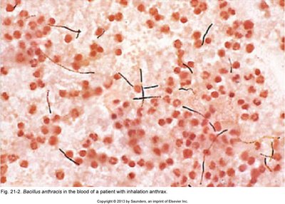 Bacillus anthracis in blood smear from inhalation anthrax patient