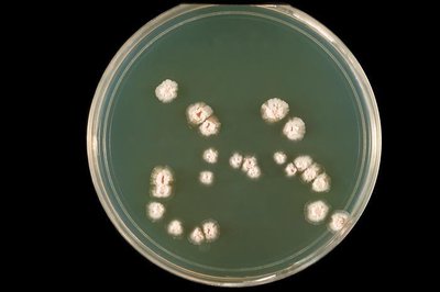 Chronic actinomycosis infection of the face