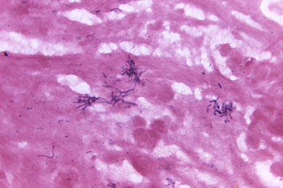 Nocardia colonies on agar plate