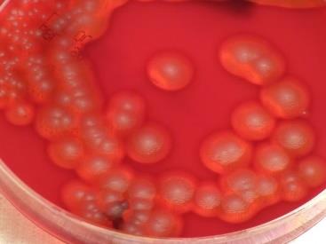 Bacillus cereus colonies on blood agar