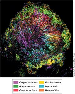 Structured microbial community of dental plaque