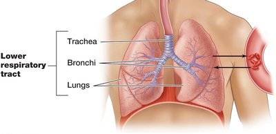 Lower respiratory tract