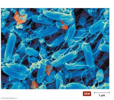 Crystals of Bt toxin from Bacillus thuringiensis