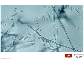 Light micrograph of actinomycetes filaments