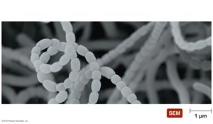SEM of streptococci chains